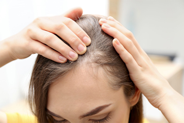 Hairfall and Baldness