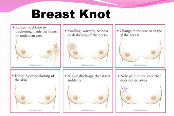 Breast Knot