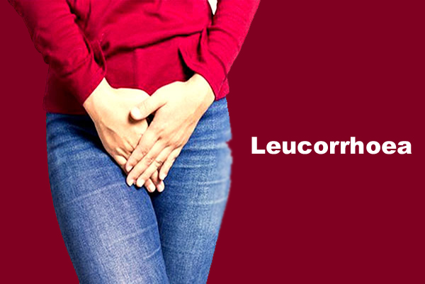 Leucorrhoea